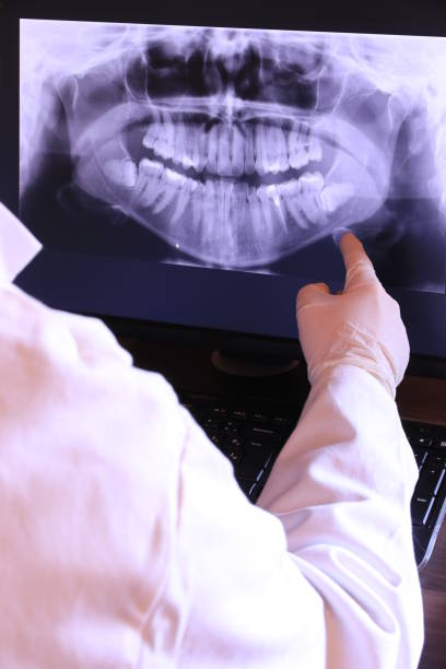 Best Emergency Wisdom Teeth Removal in Albany, OR
