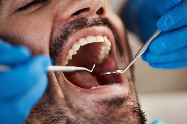Best Emergency Tooth Extraction in Albany, OR